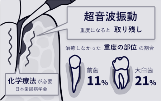 ブルーラジカル　従来の治療法　超音波振動