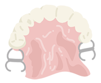 部分入れ歯