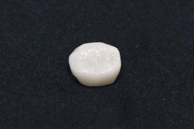セラミックの詰め物・かぶせ物 ジルコニアクラウン(単色)