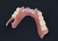 入れ歯 TUMデンチャー