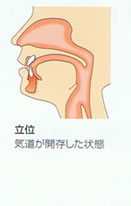 睡眠時無呼吸症候群　立位