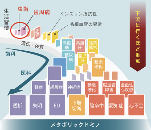 メタボリックドミノ　図