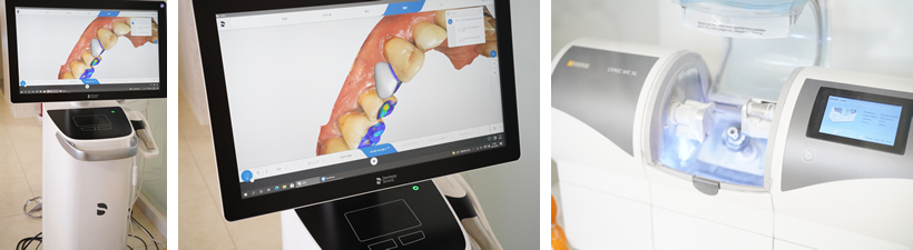 ＣＥＲＥＣ　セレック