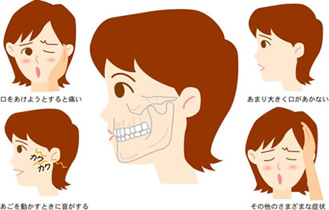 tch 症状