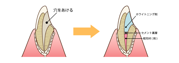 治療方法