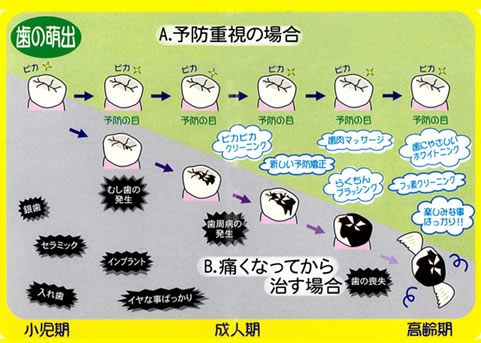 予防 メンテナンス 治療段階