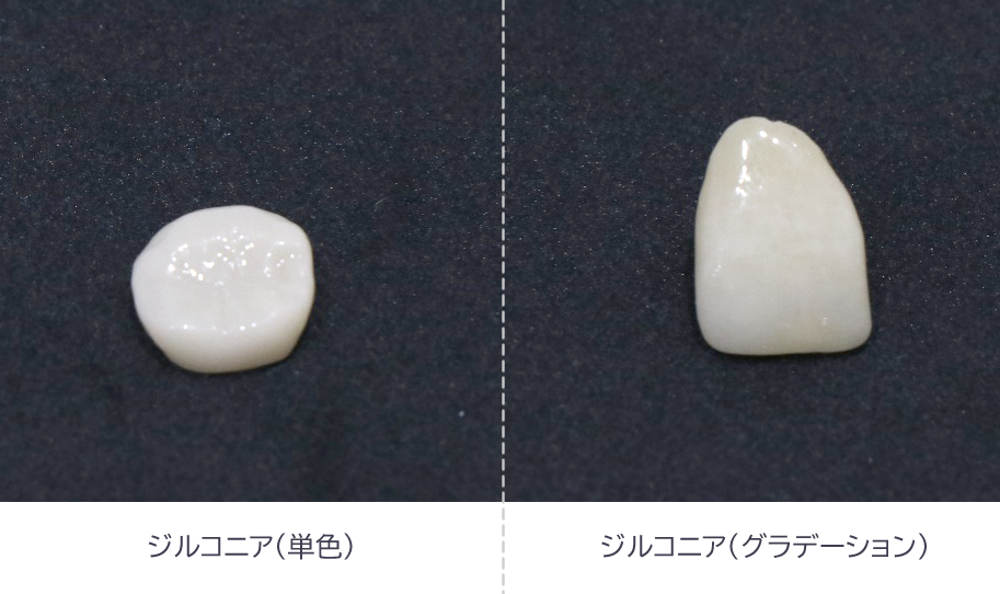 ジルコニアクラウン　かぶせ物