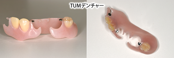 TUMデンチャー