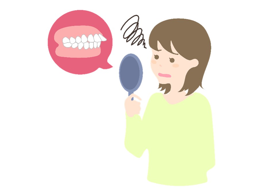 出っ歯　女性　悩む