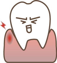 歯肉の状態　炎症