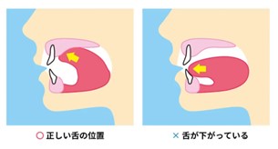 舌　位置