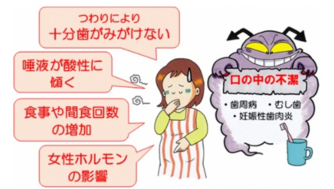 妊娠期　歯周病