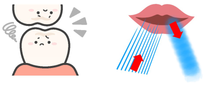 嚙み合わせ 口呼吸