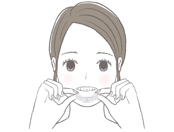 矯正治療 マウスピース矯正 女性