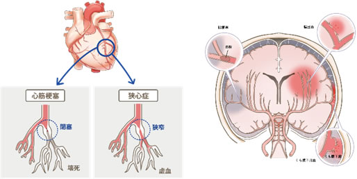 心臓・脳血管疾患