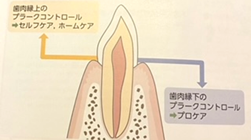 プロケアとセルフケア