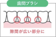 歯間ブラシ　隙間が広い部分に