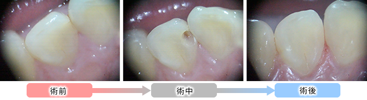 保険内診療