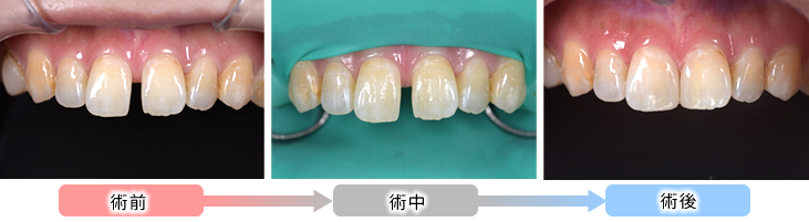 自費治療