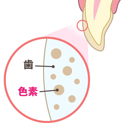 歯の構造　ホワイトニング　色素分子